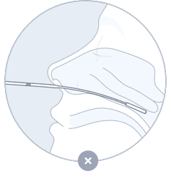 Upper nasal swab diagram